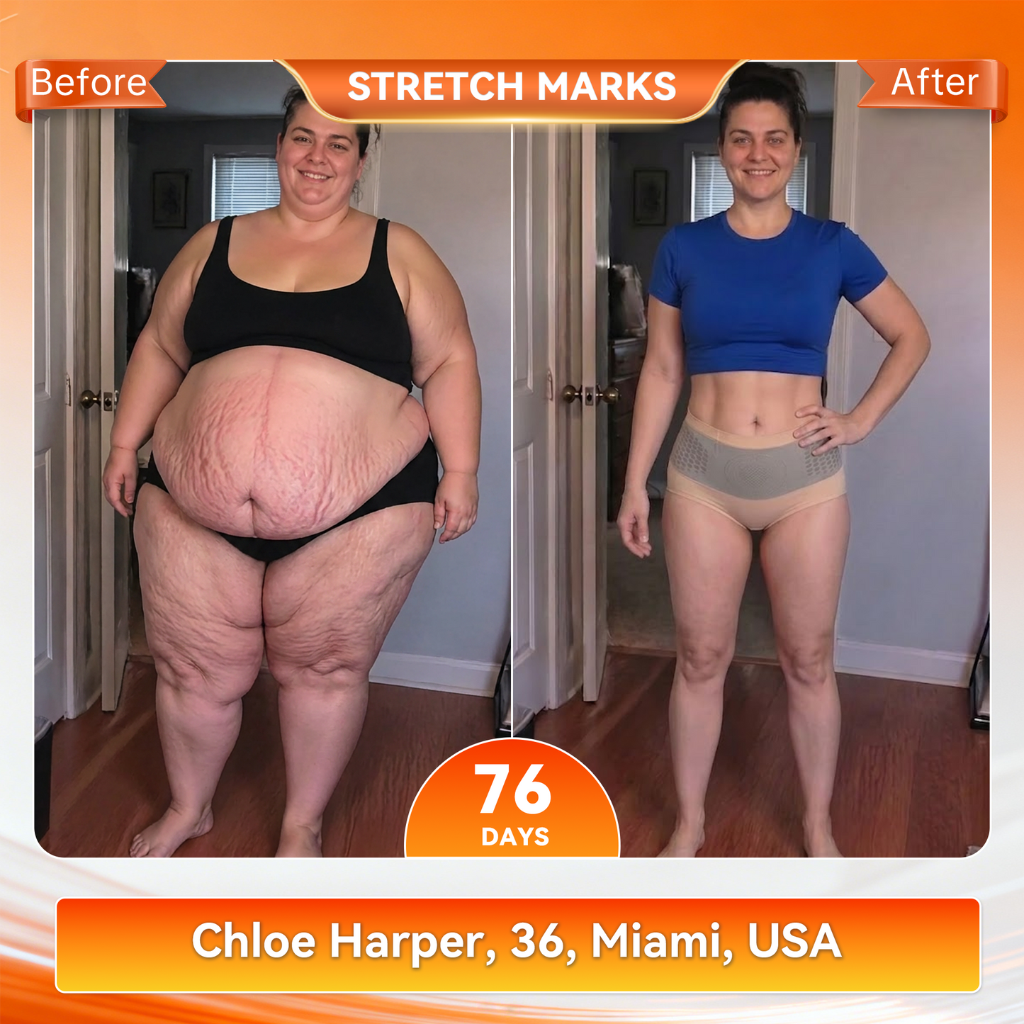 𝐎𝐟𝐟𝐢𝐜𝐢𝐚𝐥 𝐁𝐫𝐚𝐧𝐝 𝐒𝐭𝐨𝐫𝐞 🇺🇸| cicatrizant® 𝟐𝟎𝟐𝟔 𝐌𝐨𝐫𝐢𝐧𝐠𝐚 x 𝐁𝐞𝐫𝐛𝐞𝐫𝐢𝐧𝐞 x 𝐍𝐀𝐃+ 𝟔-𝐈𝐧-𝟏 𝐌𝐢𝐜𝐫𝐨-𝐏𝐚𝐫𝐭𝐢𝐜𝐥𝐞 𝐒𝐜𝐮𝐥𝐩𝐭𝐢𝐧𝐠 & 𝐅𝐚𝐭-𝐁𝐮𝐫𝐧 𝐒𝐡𝐨𝐫𝐭𝐬 (Women + Men with Enhanced Male Vitality Blend)