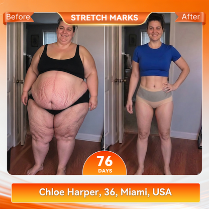 𝐎𝐟𝐟𝐢𝐜𝐢𝐚𝐥 𝐁𝐫𝐚𝐧𝐝 𝐒𝐭𝐨𝐫𝐞 🇺🇸| cicatrizant® 𝟐𝟎𝟐𝟔 𝐌𝐨𝐫𝐢𝐧𝐠𝐚 x 𝐁𝐞𝐫𝐛𝐞𝐫𝐢𝐧𝐞 x 𝐍𝐀𝐃+ 𝟔-𝐈𝐧-𝟏 𝐌𝐢𝐜𝐫𝐨-𝐏𝐚𝐫𝐭𝐢𝐜𝐥𝐞 𝐒𝐜𝐮𝐥𝐩𝐭𝐢𝐧𝐠 & 𝐅𝐚𝐭-𝐁𝐮𝐫𝐧 𝐒𝐡𝐨𝐫𝐭𝐬 (Women + Men with Enhanced Male Vitality Blend)