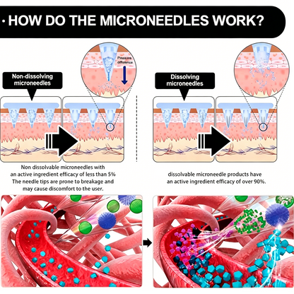 Last Day 50% OFF Berberine 10-in-1 Microneedle Patch, All Skin Types Safe