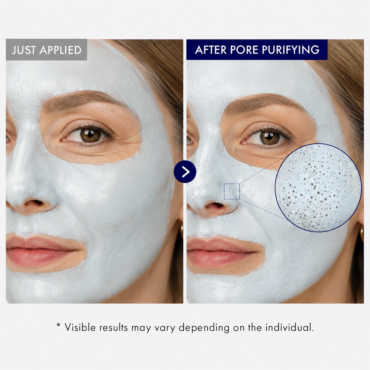 cicatrizant® - 🔥🎁Anti-aging, firming, wrinkle-reducing, blackhead-removing, 4-in-1 natural formula mud mask